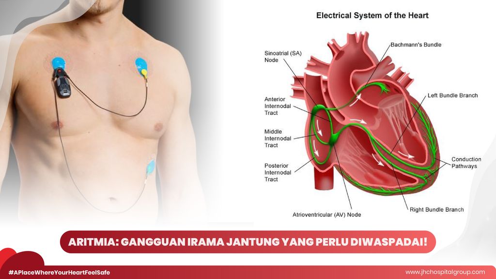 Aritmia: Gangguan Irama Jantung yang Perlu Diwaspadai
